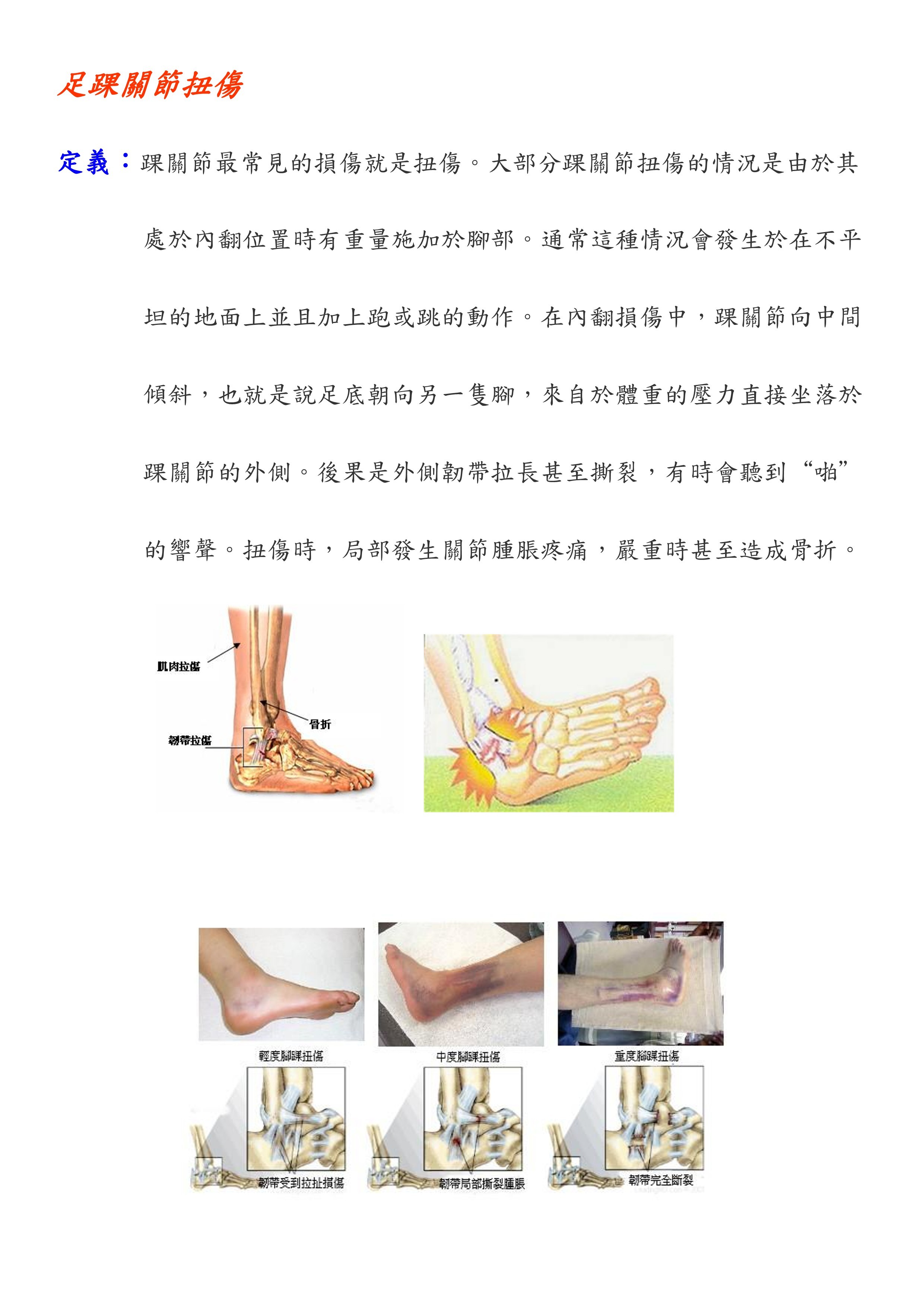 足踝關節扭傷